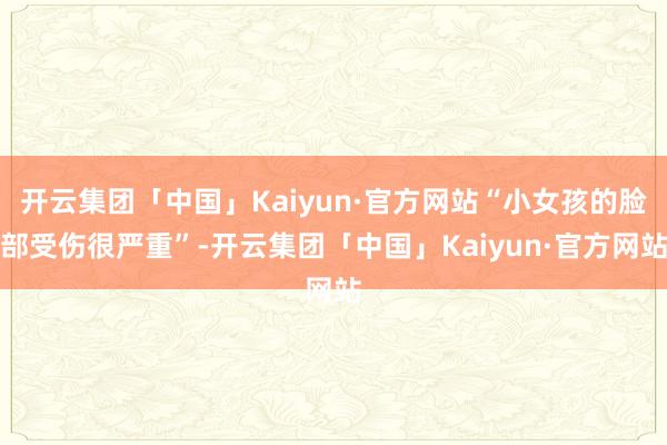 开云集团「中国」Kaiyun·官方网站“小女孩的脸部受伤很严重”-开云集团「中国」Kaiyun·官方网站